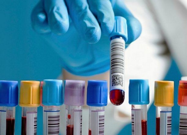Bioquímicos en alerta con SEROS