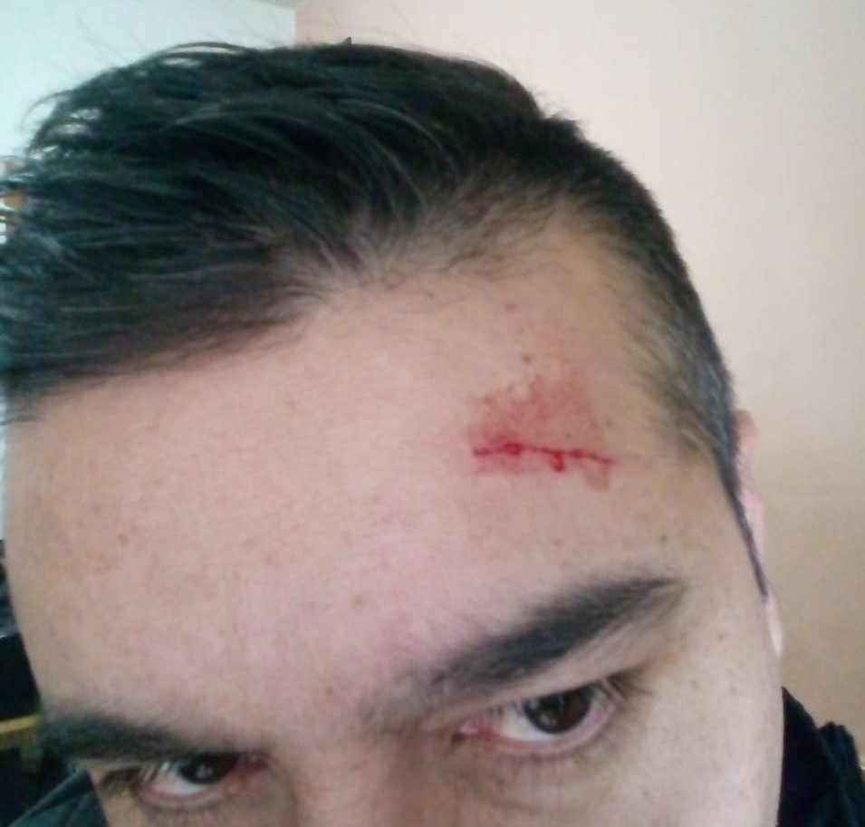 Enojado en el control, le pegó una piña al policía