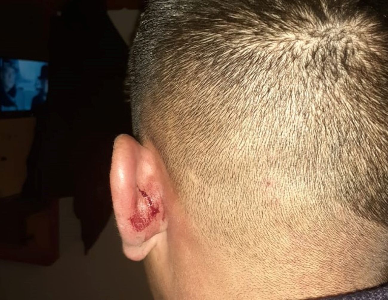 Policías fueron brutalmente agredidos en Cholila (Policía del Chubut)