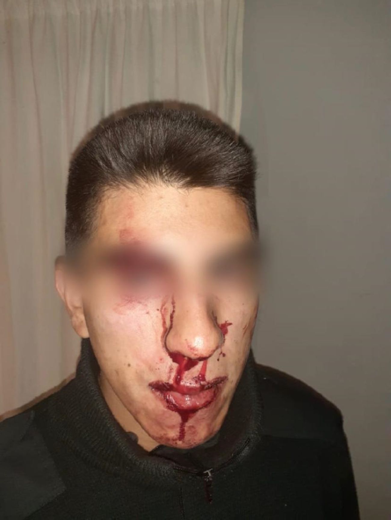 Policías fueron brutalmente agredidos en Cholila (Policía del Chubut)