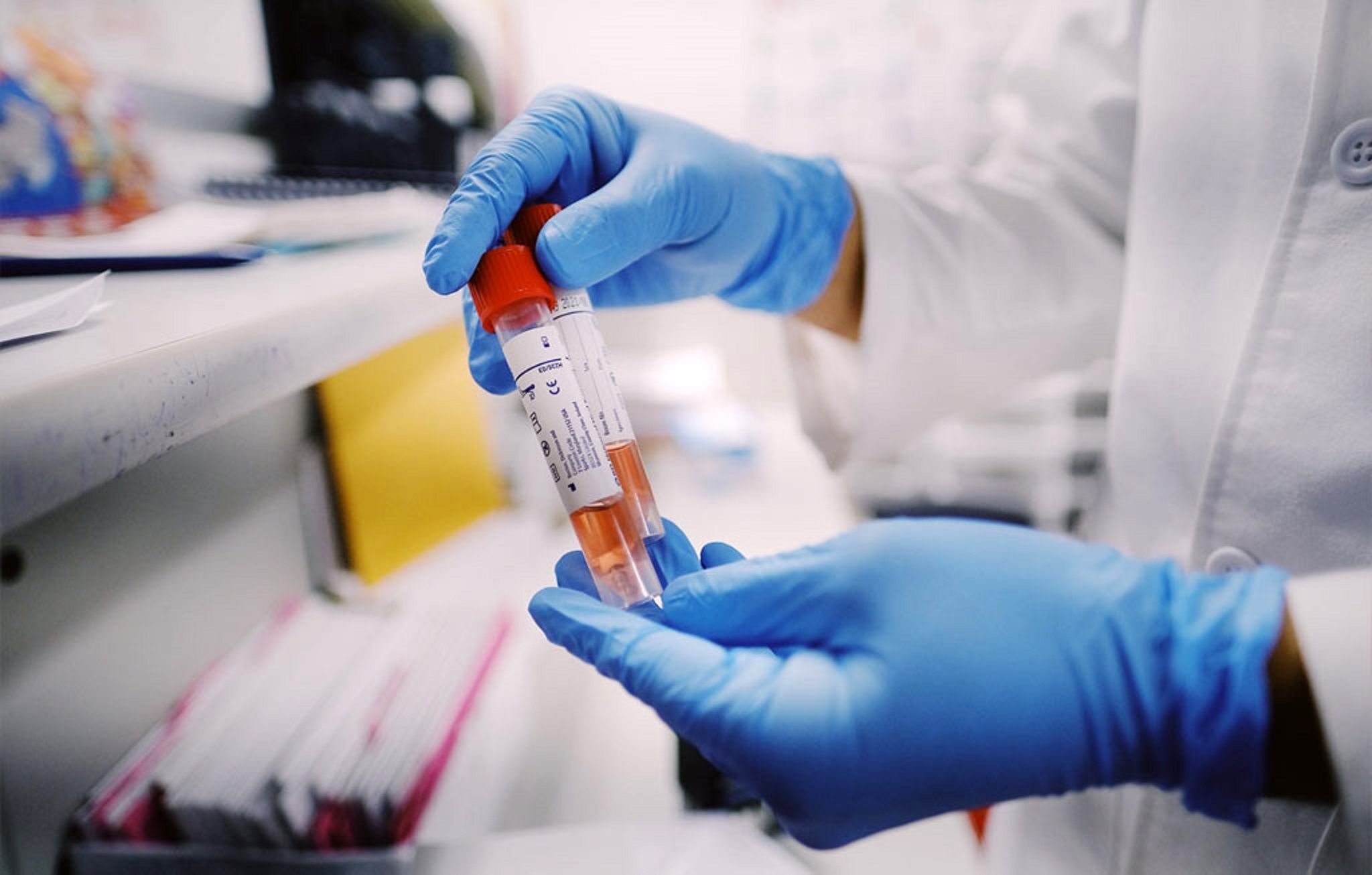 COVID: Hay 108 nuevos contagios en Esquel y 45 en Trevelin