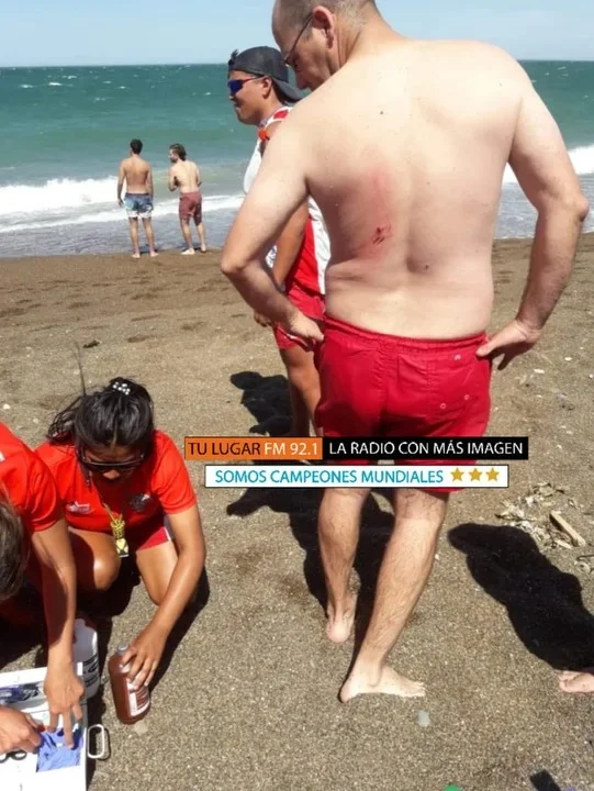 Un hombre caminaba por Playa Unión y lo atacó un lobo marino