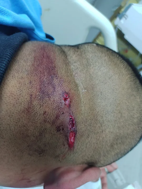 Ataque brutal: Quiso matar a un policía en un almacén y le disparó a quemarropa
